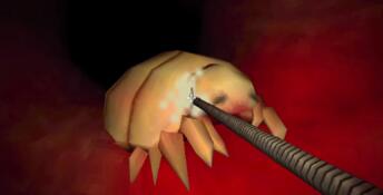 Revenge Of The Colon