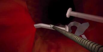Revenge Of The Colon PC Screenshot