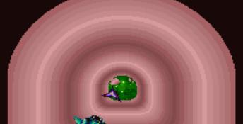 Rex Ronan: Experimental Surgeon SNES Screenshot